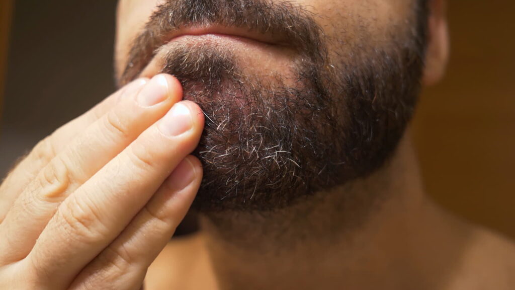 Dermatitis seborreica barba tratamiento
