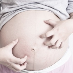 colestasis en el embarazo